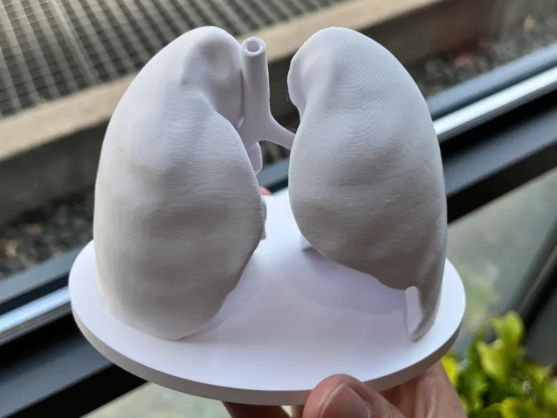 肺部医学教育模型