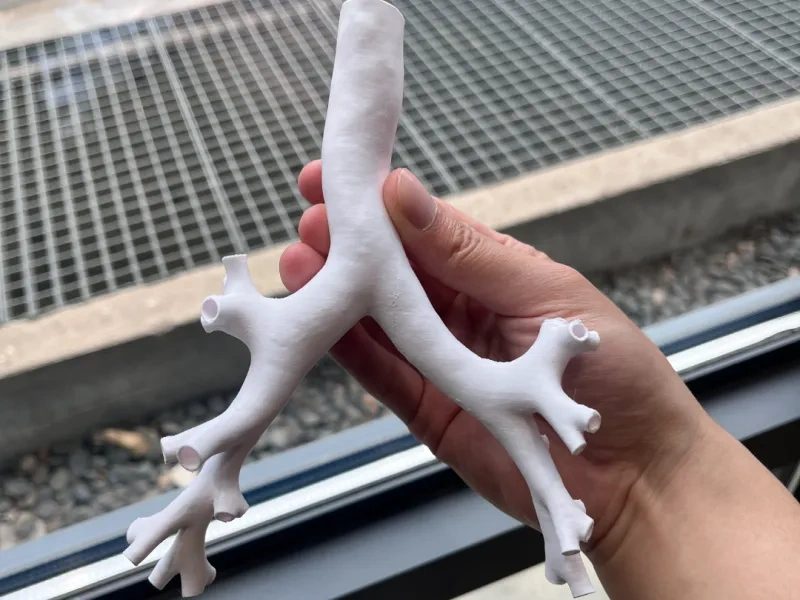 1：1支气管模型树